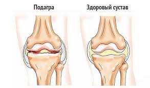 161e5516 acd8 420f 964f 3c83d134cbb2