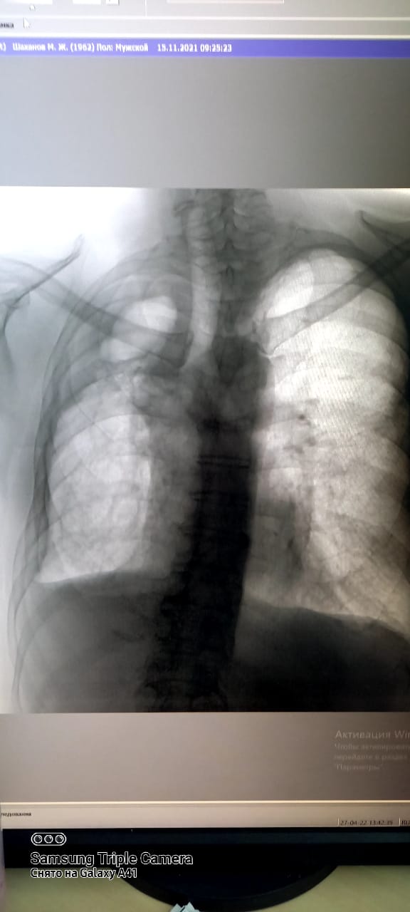 5b380e1e 29dc 4135 8c82 f4d181ba8c2d