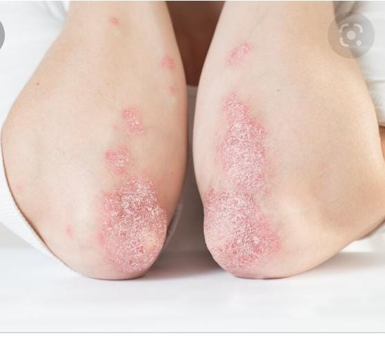 b7aeeddc 439f 47ab b691 89fe24b2f6dd