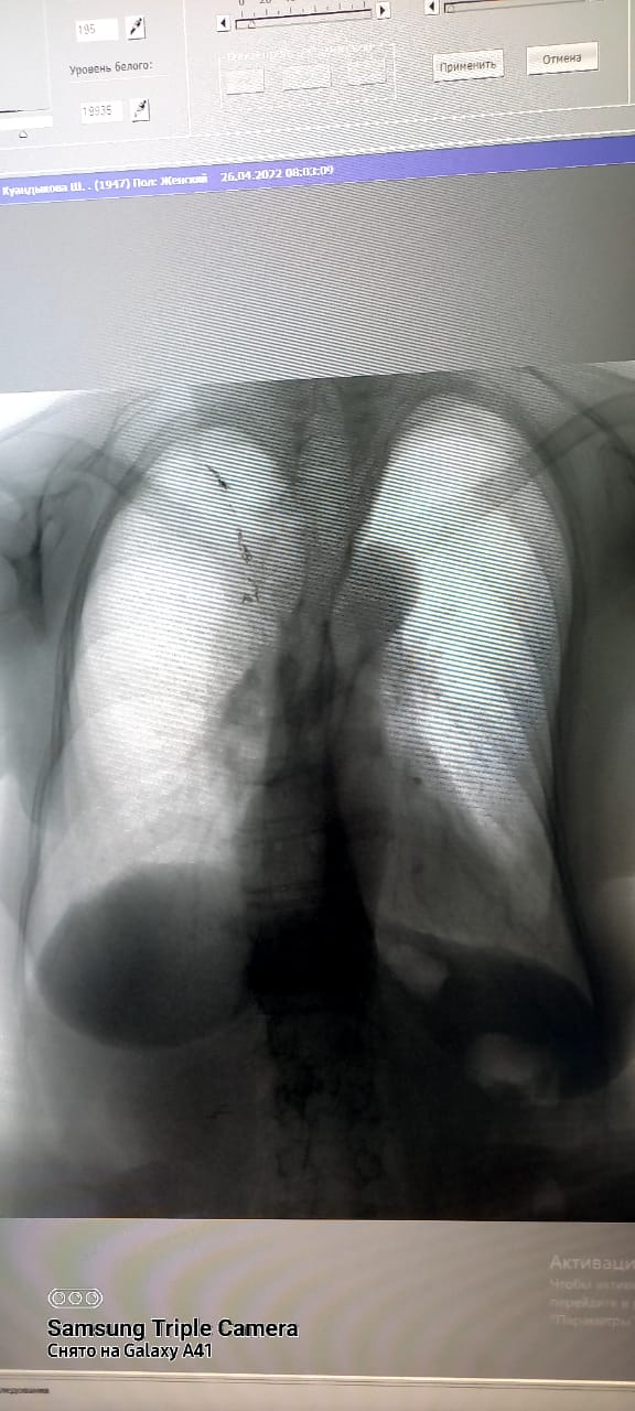 f888d545 cef4 4ee7 9872 374260dfa58d